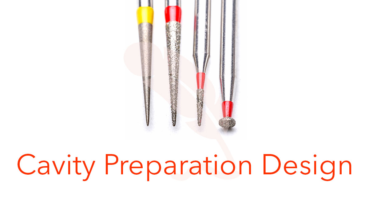 Cavity preparation design
