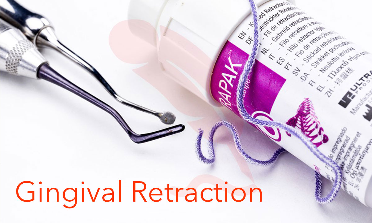 Gingival Retraction