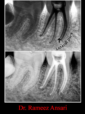 Clinical Cases Anatomical Variation