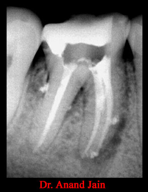 Clinical Cases Anatomical Variation