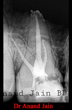 Clinical Cases Anatomical Variation