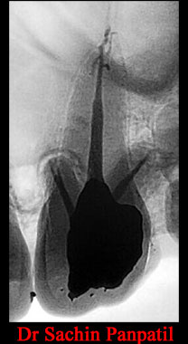 Clinical Cases Anatomical Variation