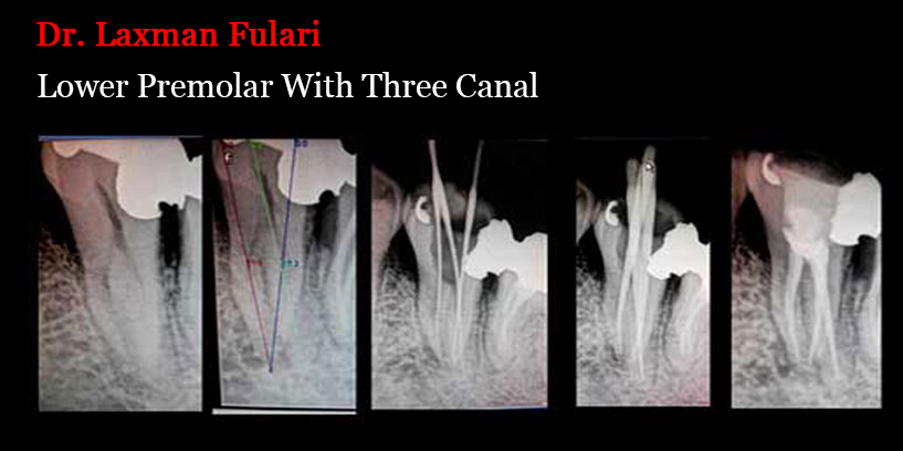 Clinical Cases Anatomical Variation