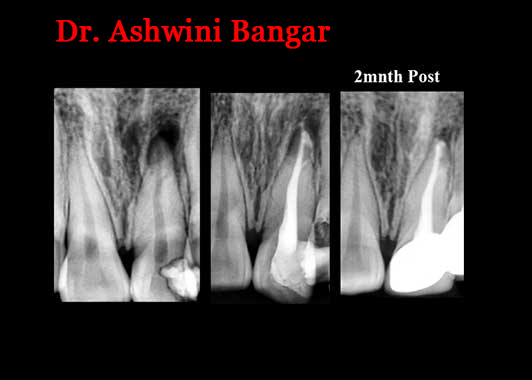 Clinical Cases Anatomical Variation