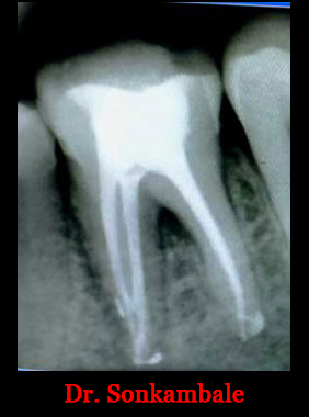Clinical Cases Anatomical Variation