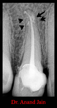 Clinical Cases Anatomical Variation