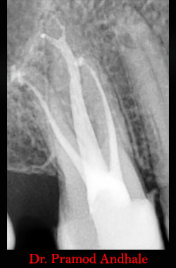 Clinical Cases Anatomical Variation