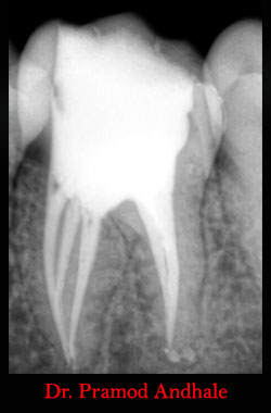 Clinical Cases Anatomical Variation