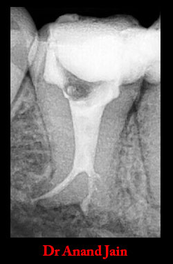 Clinical Cases Anatomical Variation