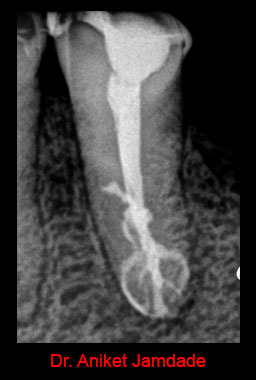 Clinical Cases Anatomical Variation