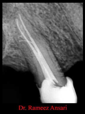 Clinical Cases Anatomical Variation
