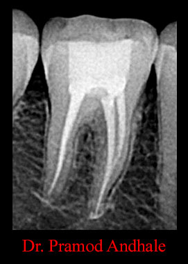 Clinical Cases Curvature