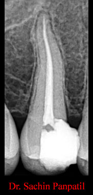 Clinical Cases Curvature