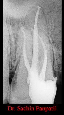 Clinical Cases Curvature