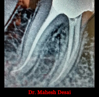 Clinical Cases Curvature