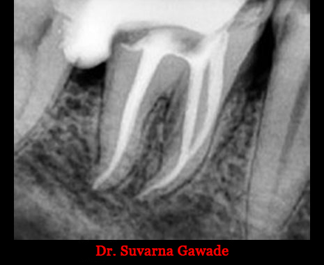 Clinical Cases Curvature
