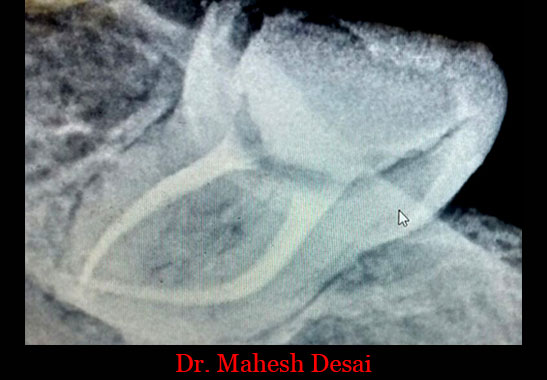 Clinical Cases Curvature