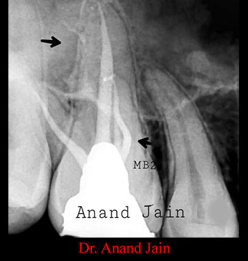 Clinical Cases Curvature