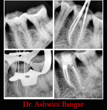 Clinical Cases Curvature