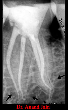 Clinical Cases Curvature