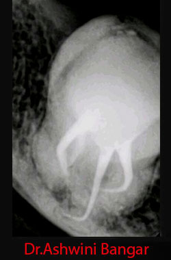 Clinical Cases Curvature