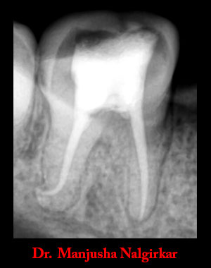 Clinical Cases Curvature