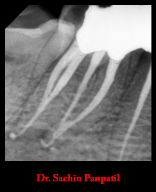 Clinical Cases Curvature