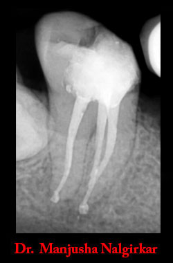 Clinical Cases Curvature